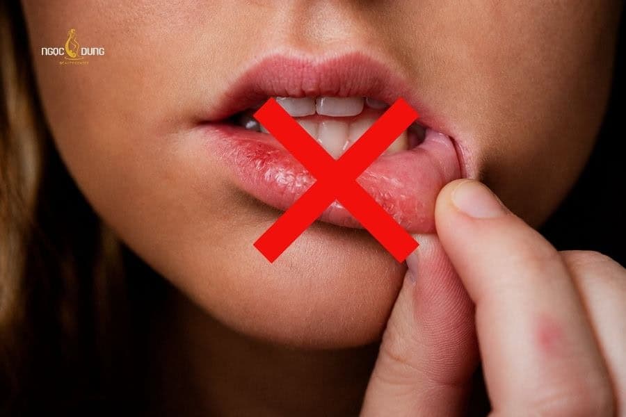 Cách vệ sinh răng miệng sau khi phun môi, lên màu đẹp 6 Không tự ý dùng tay bóc vảy môi sau phun