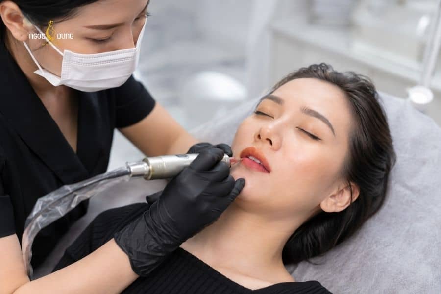 Phun môi ủ tê hay không ủ tê phụ thuộc vào tình trạng môi và khả năng chịu đau của bạn