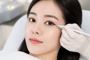 Phun cả mí trên và mí dưới có thể giúp mắt cân đối hơn
