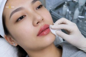 Phun môi bị chảy nước mô thường là phản ứng tự nhiên của cơ thể