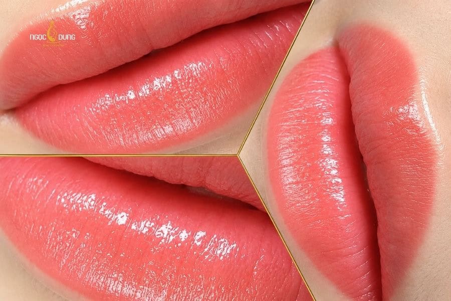 Phun môi collagen thường giữ màu lâu hơn và hỗ trợ cải thiện kết cấu môi hiệu quả