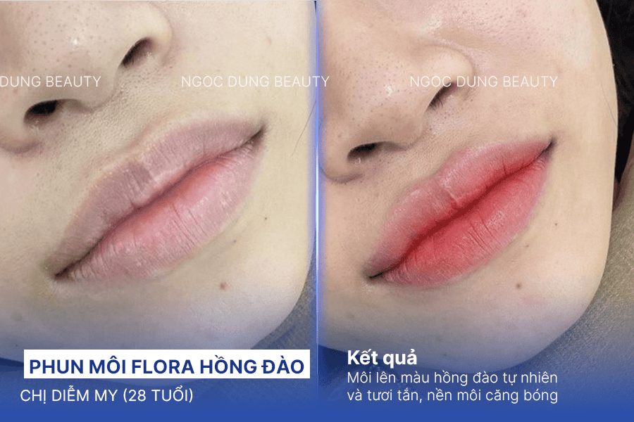 Xăm môi có hại không? Tác hại khi thực hiện sai cách 13 Phun môi an toàn tại Ngọc Dung