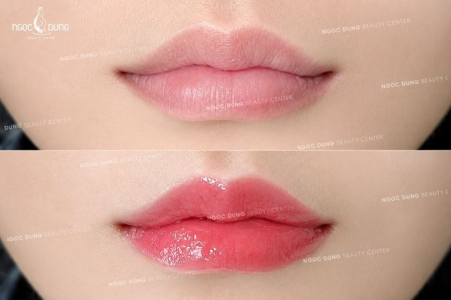 Môi thâm nên dùng son màu gì? Top 8 màu son cực đỉnh 10 Kết quả phun môi Silk Lips tại Ngọc DungKết quả phun môi Silk Lips tại Ngọc Dung