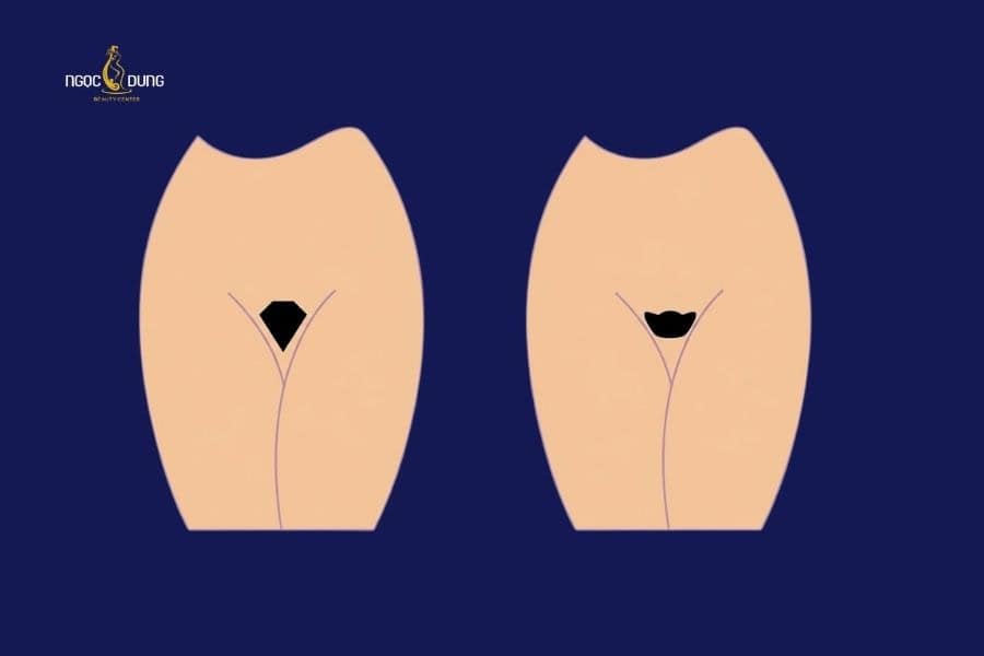 Tạo hình bikini phong thủy thu hút tài lộc và may mắn 3 Người mệnh Kim có thể tạo hình bikini dáng thỏi vàng hoặc kim cương