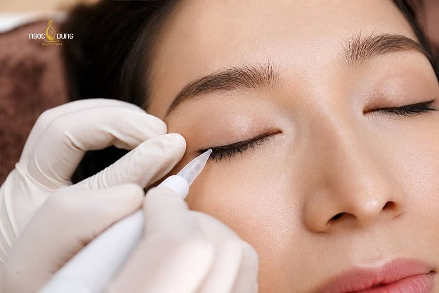 Chuyên viên tay nghề yếu dễ làm bạn cảm thấy đau khi phun mí