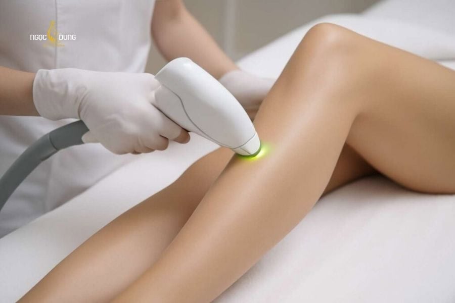 Có nên cạo ria mép tuổi dậy thì không? Cách xử lý an toàn 8 Triệt lông an toàn tại Ngọc Dung