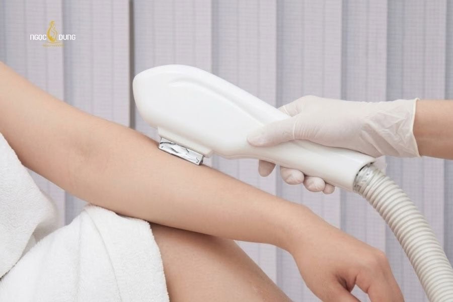 Giá triệt lông nửa tay còn phụ thuộc vào tình trạng của bạn