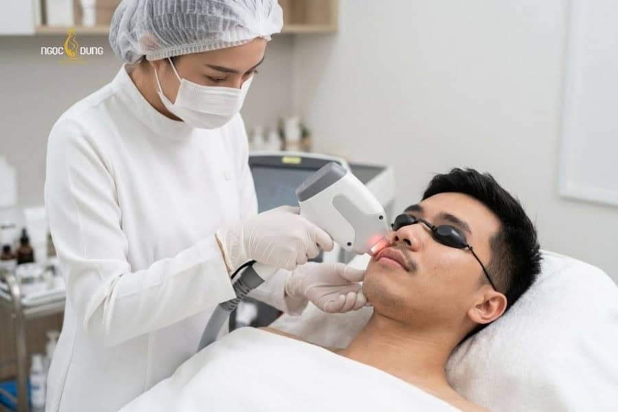 Triệt ria mép có mọc lại không? Bí quyết duy trì hiệu quả 2 Triệt lông ria mép với công nghệ cao thường có kết quả tốt và bền lâu hơn