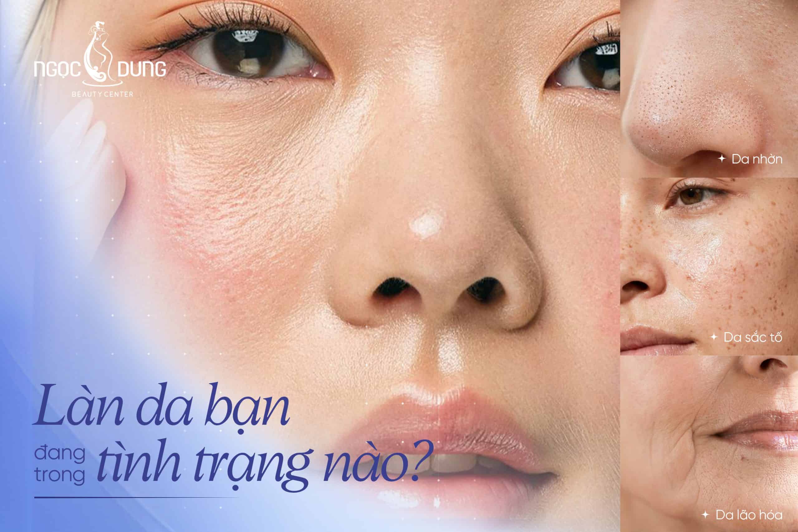 Phác đồ quản lý chất lượng da tại Ngọc Dung được thiết kế chuyên biệt cho từng loại da