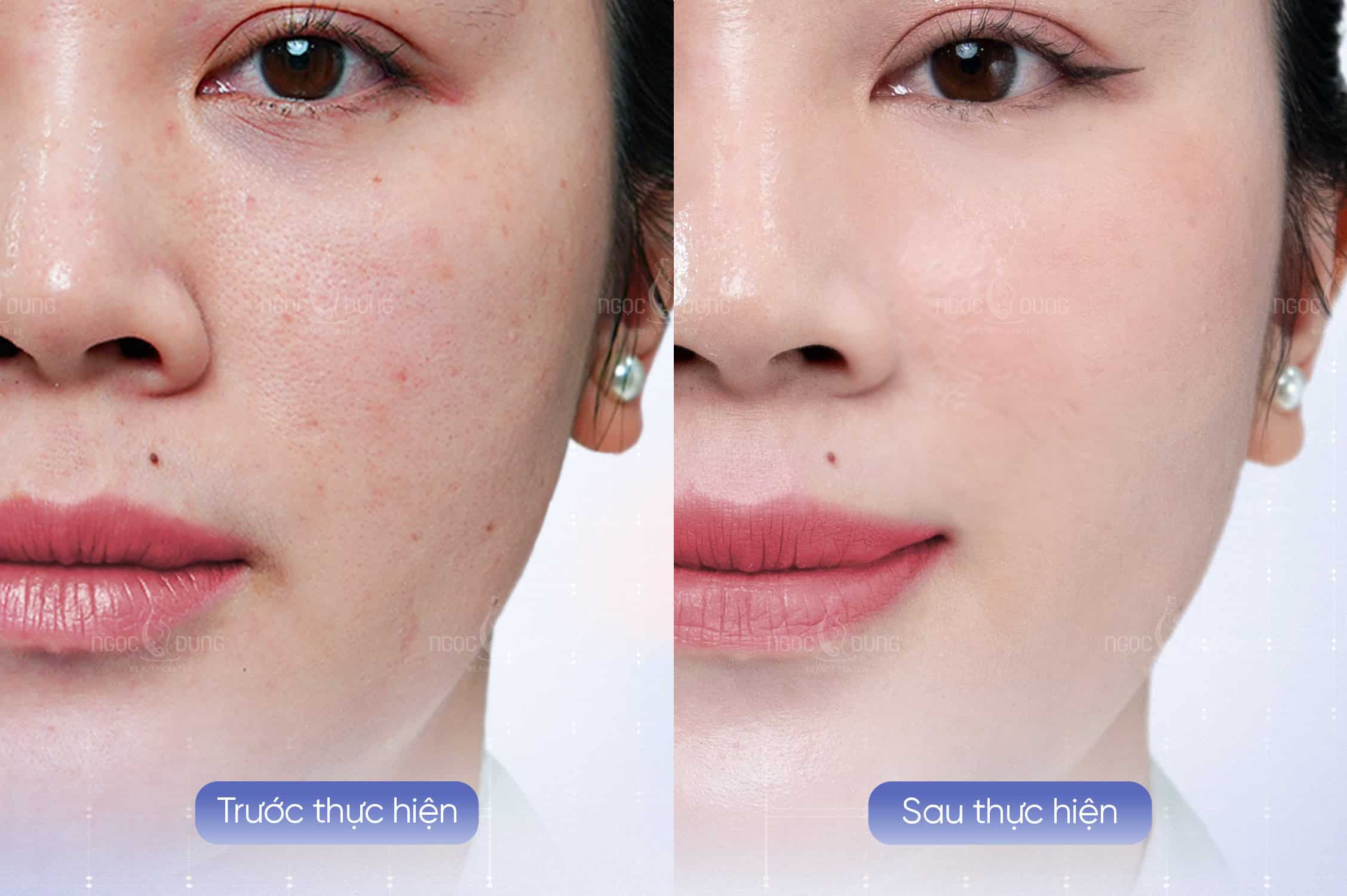 Tăng Sức Mạnh Của Phác Đồ Quản Lý Chất Lượng Da Với ECM Skin Rebuild 5 Nền da sẽ được củng cố hiệu quả để đảm bảo hấp thụ tốt phác đồ quản lý chất lượng da