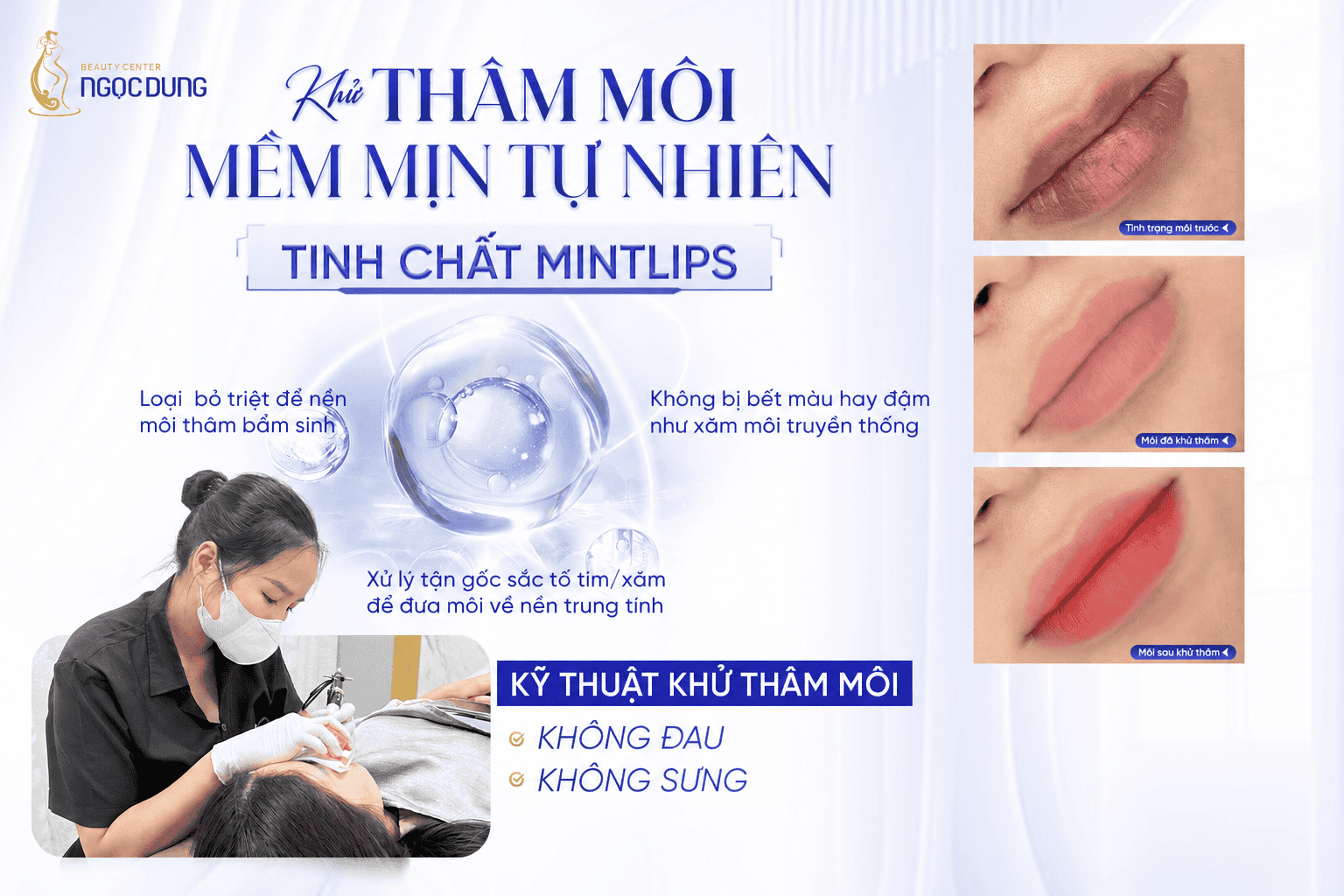 Khử thâm môi mint lips