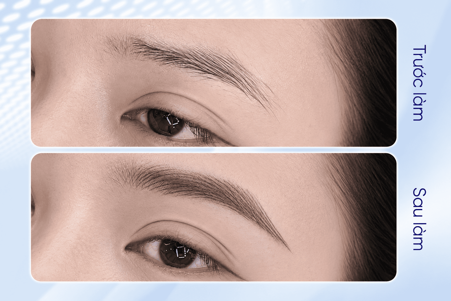 Kết quả điêu khắc chân mày sau 45 phút của chị Vy