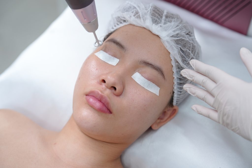 Ngọc Dung là một trong những địa chỉ trị thâm uy tín được nhiều khách hàng tin chọn