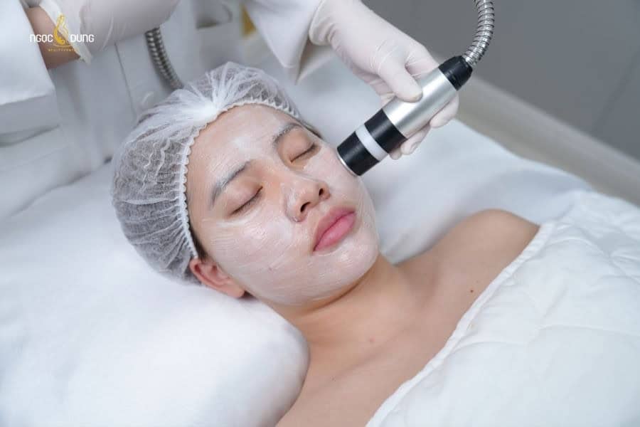 Giá ủ trắng mặt phụ thuộc vào công nghệ điều trị 