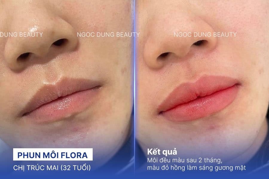 Kết quả phun môi cam san hô trẻ trung của chị Chi