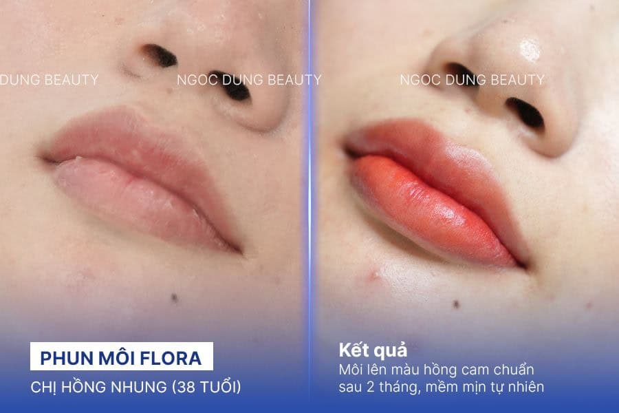 Môi căng mọng mềm mịn sau 60 phút phun tại Ngọc Dung