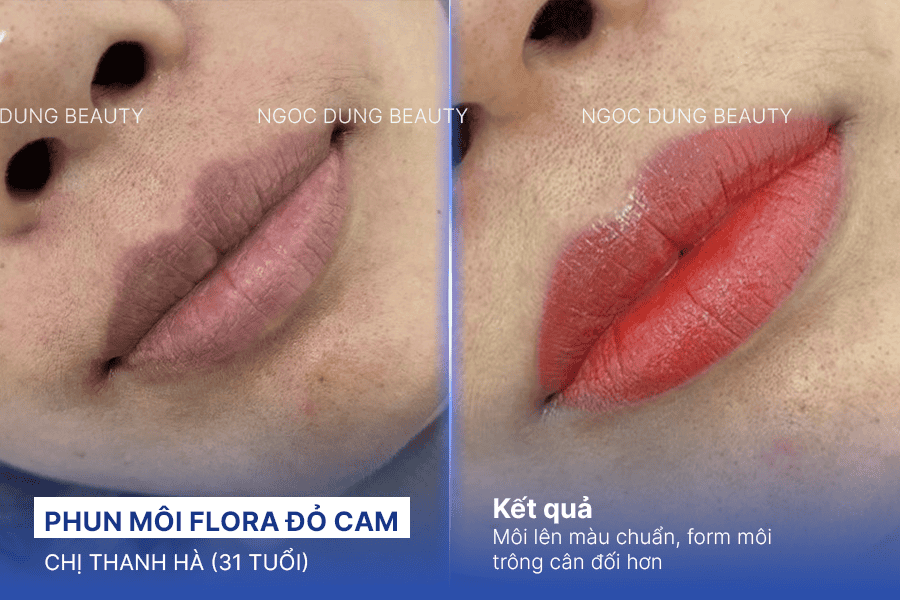 Phần lớn các khách hàng đều hài lòng với kết quả phun môi tại Ngọc Dung