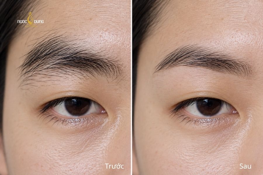 Loại bỏ phần lông mày mọc thừa, giúp đường chân mày trông gọn gàng và cân đối hơn