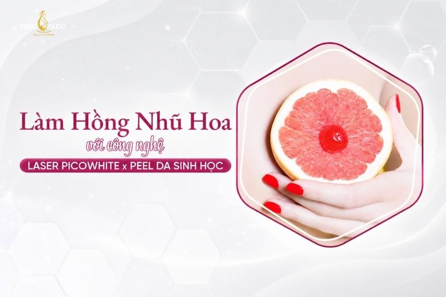 Giá làm hồng nhũ hoa dao động từ 4 triệu đồng