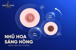 Ngọc Dung mang đến giải pháp làm hồng nhũ hoa từ công nghệ laser tân tiến chuẩn y khoa