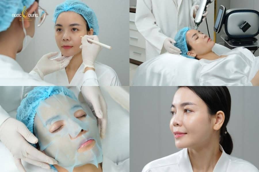 Liệu trình càng nhiều buổi điều trị sẽ càng có chi phí cao