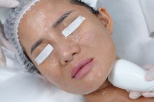 Ngọc Dung tiên phong ứng dụng Thermage FLX trong các liệu trình trẻ hóa da mặt toàn diện