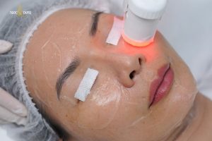 Ngọc Dung là một trong những địa chỉ trẻ hóa da được nhiều khách hàng tin chọn