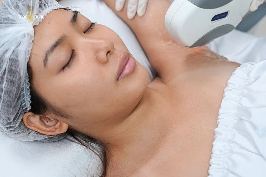 Ngọc Dung cung cấp dịch vụ triệt lông đa vùng bằng công nghệ tân tiến, hiệu quả bền lâu