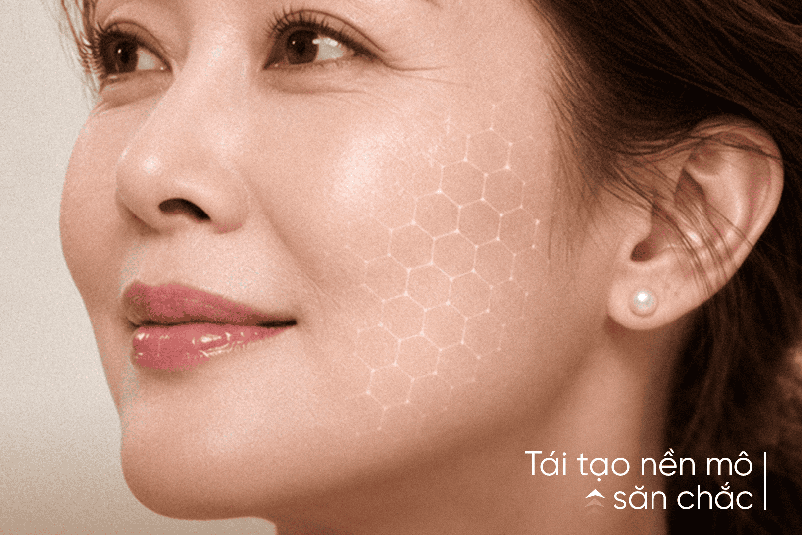 Radiesse có thể được ứng dụng theo hướng cải thiện chất lượng mô thay vì tập trung vào tạo độ đầy