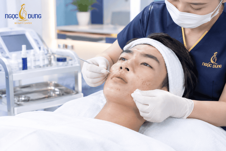 Cách trị mụn ở tuổi dậy thì nam giới tại Thẩm mỹ viện Ngọc Dung