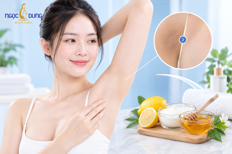 Cách trị thâm nách trong 3 ngày hiệu quả