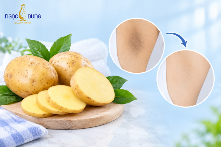 Cách trị thâm nách bằng khoai tây